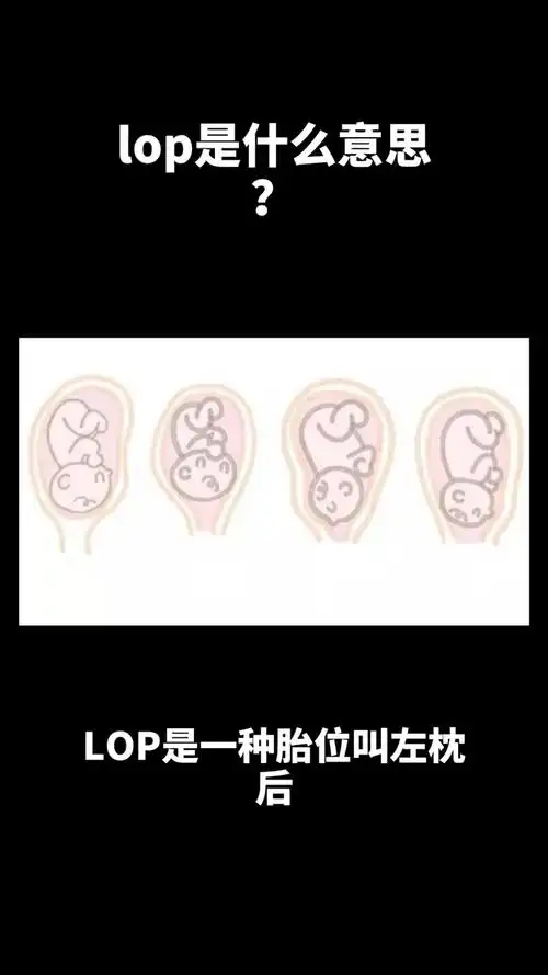lop是什么意思?你知道了吗?