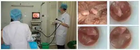 >>>>了解更多电子肛门直肠镜费用情况   如需帮助,您可以点击【在线