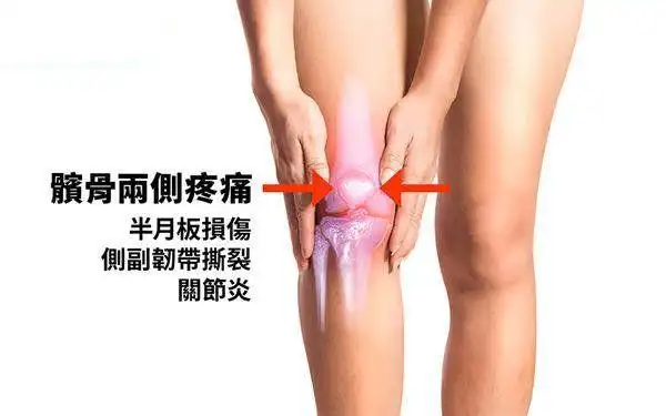 膝盖卡卡好不了当心半月板受损把握黄金治疗期