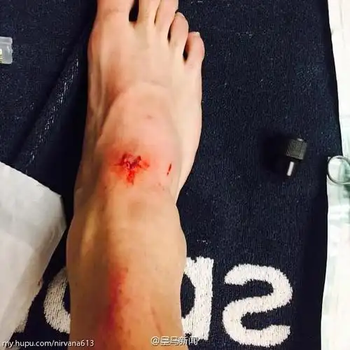 [流言板]卡瓦哈尔受伤,出战联赛成疑