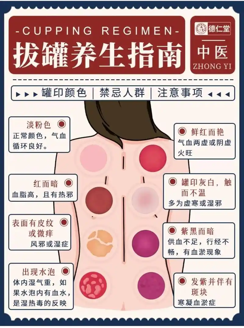 下面堂主就给宝子们讲一讲拔火罐的颜色,禁忌等事项.  →拔罐 - 抖音