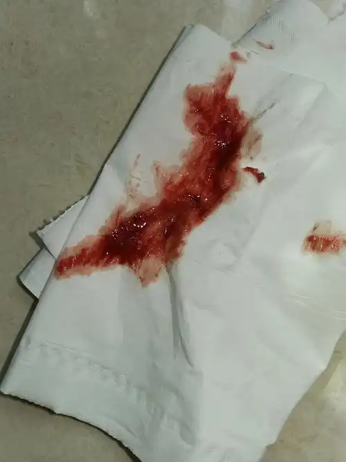 求助猫咪吐完猫粮吐血怎么办啊啊啊