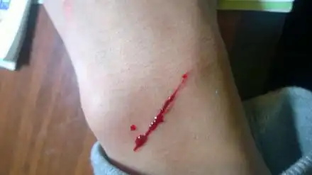 手指被刀割伤简笔画