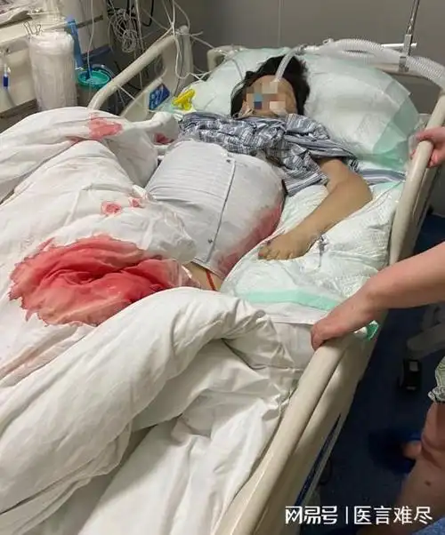 未经同意擅自手术,上海市第八人民医院致患者死亡