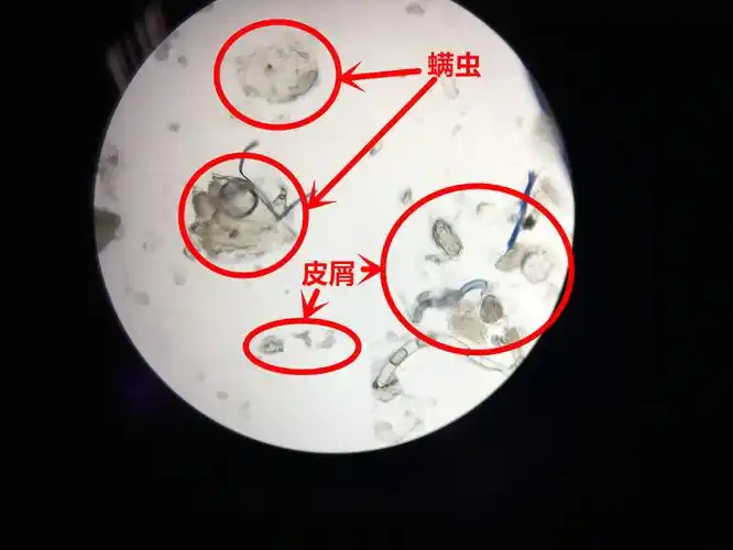 瓶瓶口,用载玻片盖在锥形瓶瓶口约30秒,取下载玻片,放置显微镜下观察