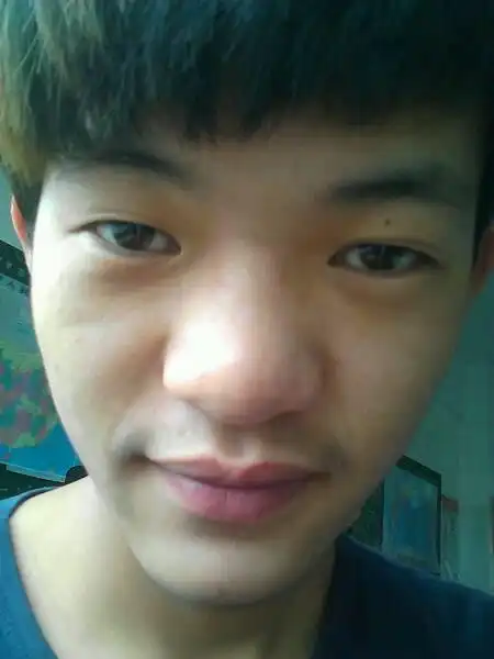 我想问问 我这个鼻子可以做手术吗 我鼻头肥大 除了做手术还有什么