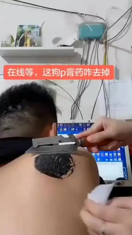 给大哥贴狗皮膏药,看得我有点慌,感觉去不掉了__财经头条