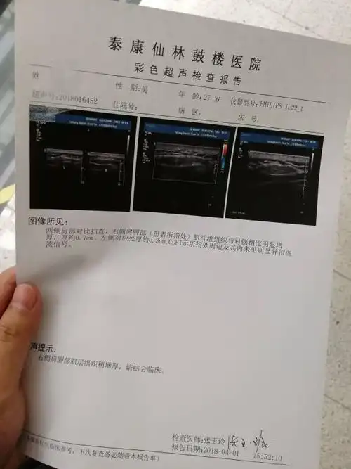 后背肩胛部涨了一个凸起来的疙瘩