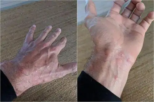 深圳市盐田区专业灭四害--欢迎致电