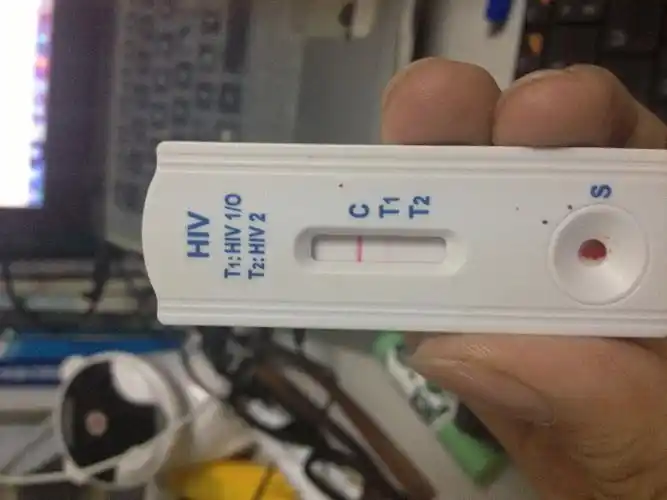 用艾康试纸监测,这是第二次,第一次只有c区一条线,第二次如图 ,t1有条