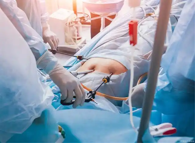 关于人流手术的误区,究竟还要坑多少人