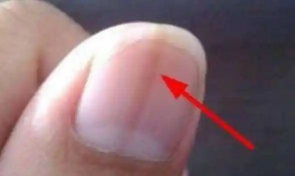 不管男女身体这个器官变硬说明是肝癌的信号