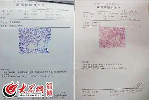 女子癌症晚期中西医结合治疗仅9个周期奇迹般治愈