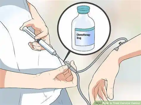 这些反应,或是担心化疗没有效果,或是担心化疗副作用太大,得不偿失.