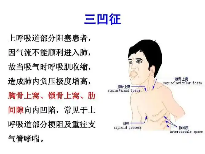 呼吸系统的解剖生理及肺部听诊ppt