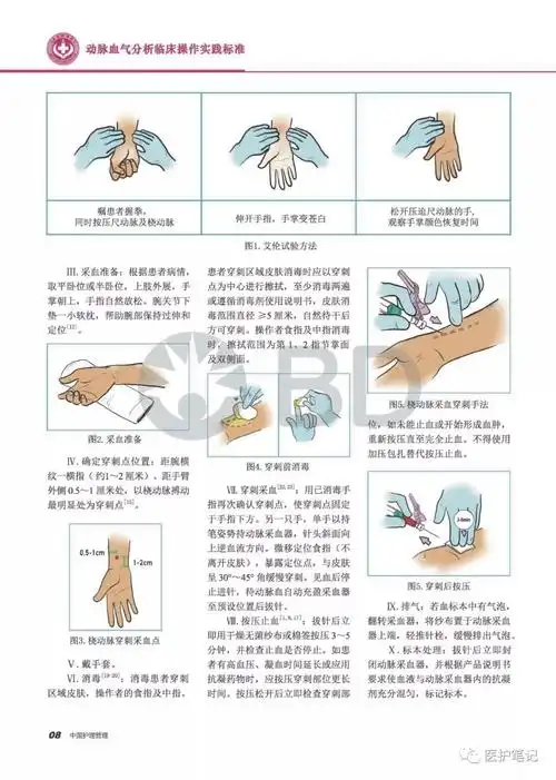 专家共识丨动脉血气分析临床操作实践标准