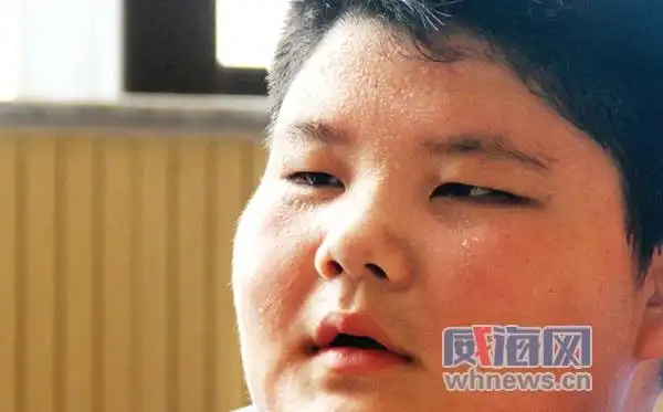 12岁1米68238斤 看小胖子如何"甩肉"