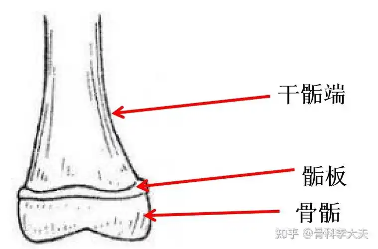 下面图片先带你来了解一下,什么是干骺端,骺板和骨骺.如下图所示.
