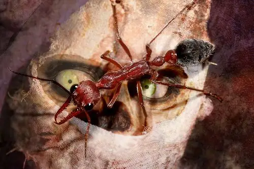 anaphylaxis | flickr – 相片分享!