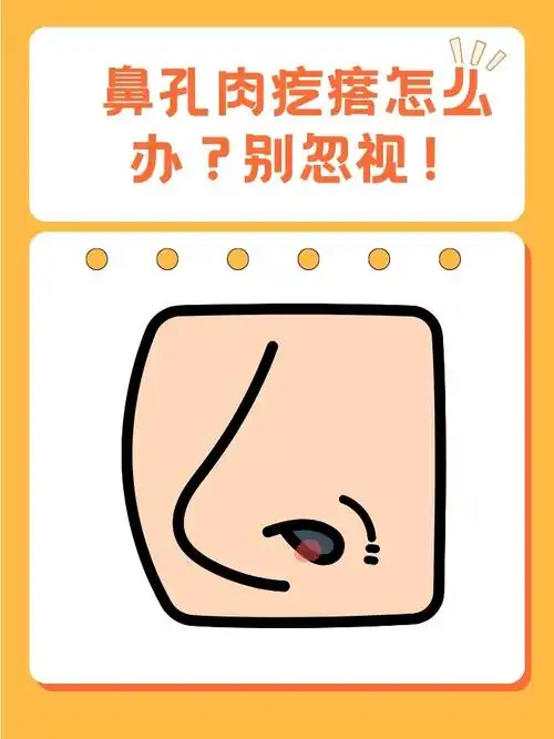 鼻孔里面有个肉疙瘩怎么办?别忽视!