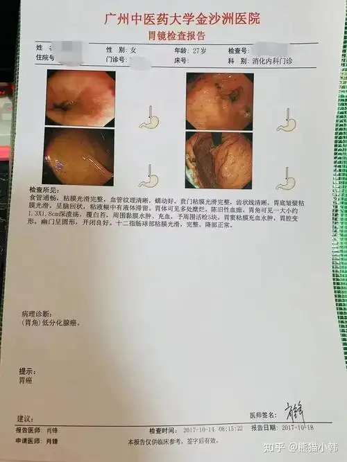 我和我的晚期胃癌