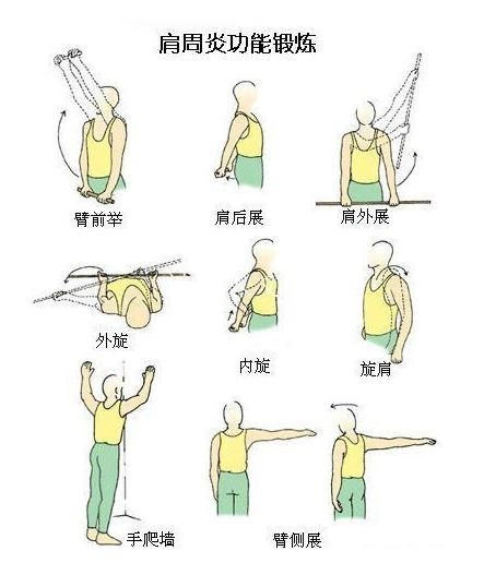 肩周炎功能锻炼图解_肩周炎_肩周炎康复锻炼 - 好大夫在线