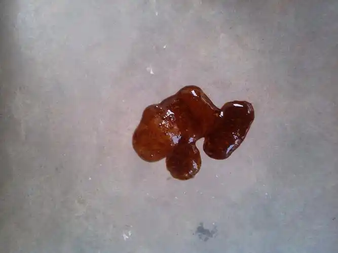 婴儿拉屎颜色深棕褐色是什么原因?