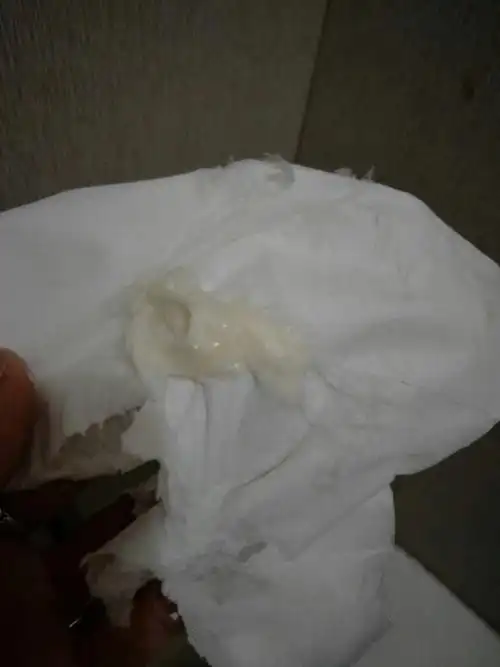 我用完消糜栓就出来好多白色的东西!