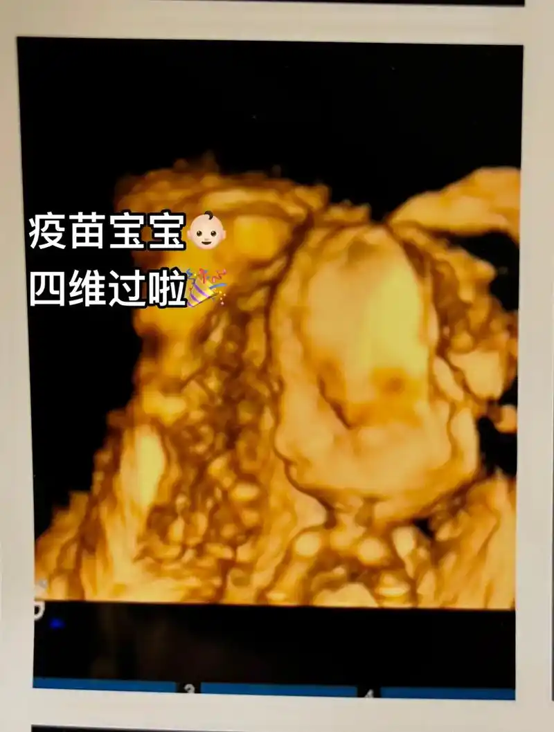 是我的疫苗宝宝,是nt,无创,四维都一路绿灯的乖宝宝!就算你 - 抖音