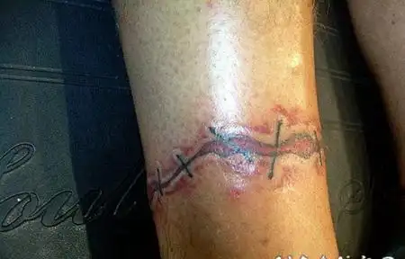 3d撕皮缝针脚踝纹身图案
