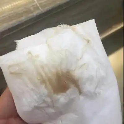 请问,现在怀孕7周,白带是这个颜色 正常吗