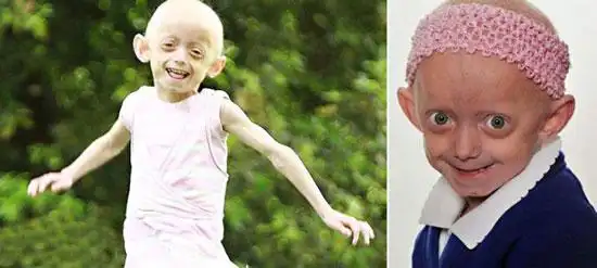 曝光世界上真实存在的变异人