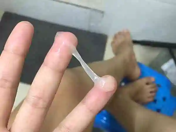 排卵排出来的东西图片长什么样子