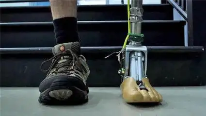 会动脑筋的假肢,像真腿一样灵活,山地也能流畅行走