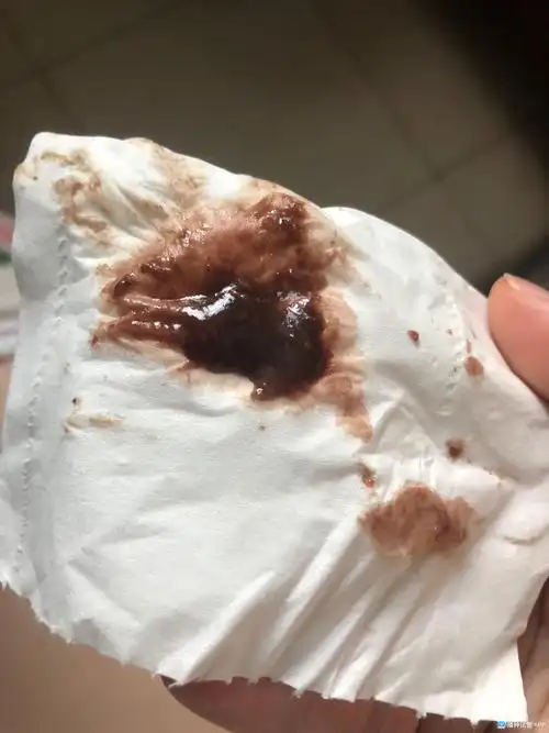 [试管婴儿]有没有组们怀孕5周有褐色分泌物