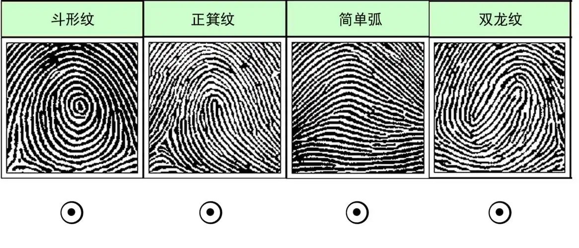 国际皮纹学研究会议确定了分类方法,按照三叉的数目与位置及纹形中心