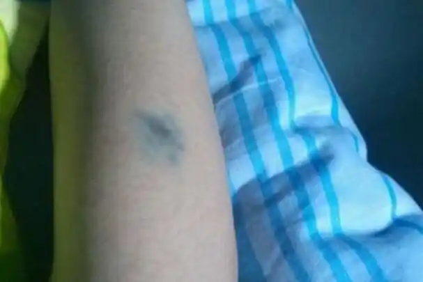 左胳膊有青色胎记传说与父母缘分较深但晚年运势较为凄凉