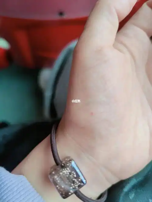 左手掌上的朱砂痣