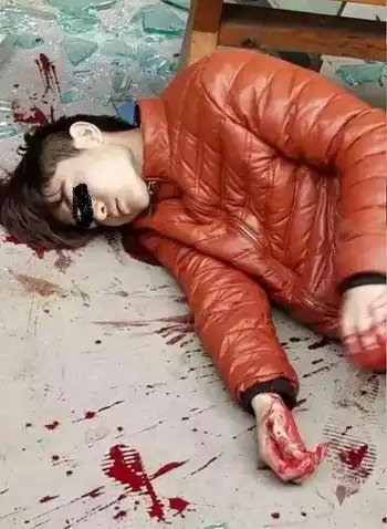 南充7名口罩男当街砍人2村民被砍成重伤