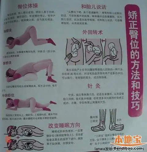 孕妇胎位不正纠正图解