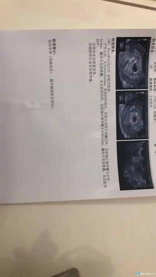 [试管婴儿]b超啦妥妥的双胞胎哦～～～感谢