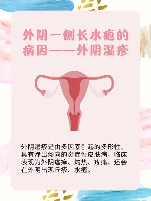 外阴一侧长水疱,应该怎么处理