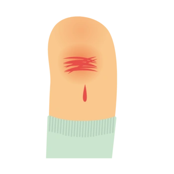卡通手指流血