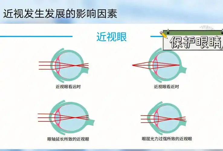 认识眼睛02了解孩子近视的原因04