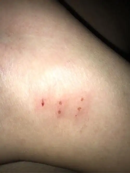 请问这样是被狗咬伤的吗