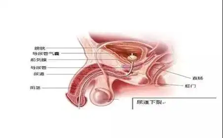 小儿尿道下裂手术分享精雕细琢还宝宝健康人生