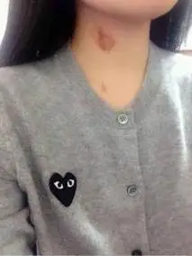 原创13岁女儿脖子出现"草莓印" ,妈妈没骂没打,一招挽救女儿恋爱观