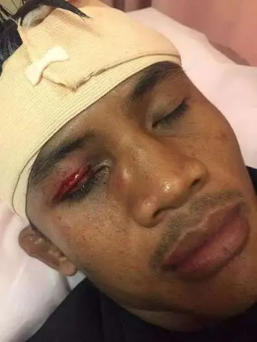 慎入泰拳王播求被暴头夸张伤口不敢看