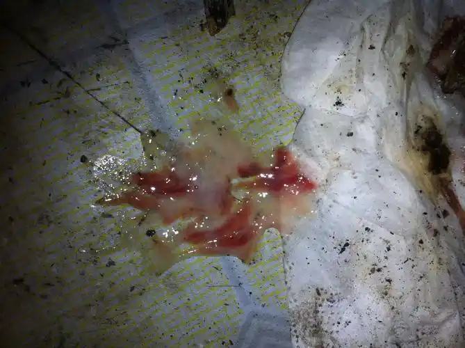 什么症状才是肺癌呢?痰中带血