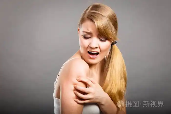 女人抓痒胳膊与过敏皮疹
